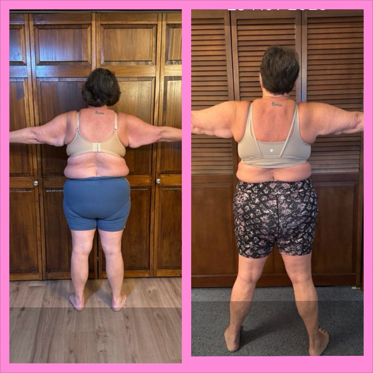 Real client before and after transformation — back view