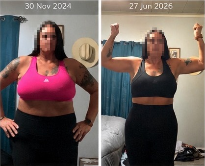 Sharon's transformation, front view, comparing 30 November 2024 with 27 June 2026