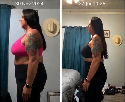 Sharon's transformation, side view, comparing 30 November 2024 with 27 June 2026